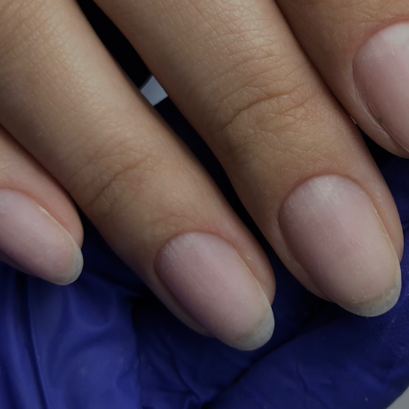 Снятие гель-лак