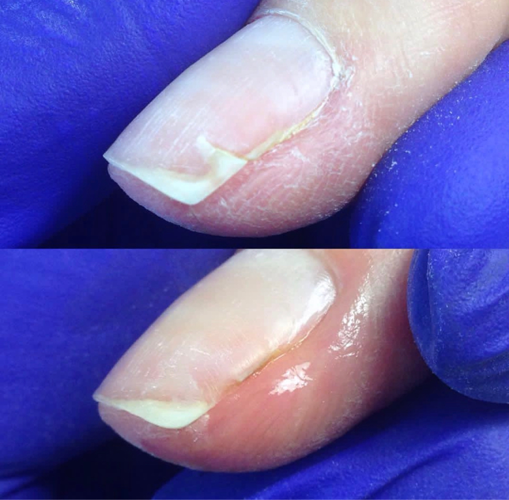 Ремонт/наращивание за 1 ноготь