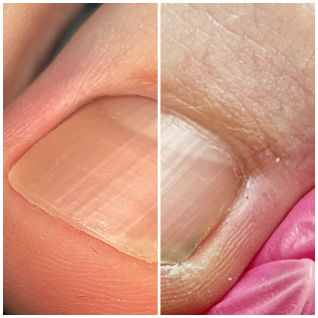 Обработка только пальцев ног