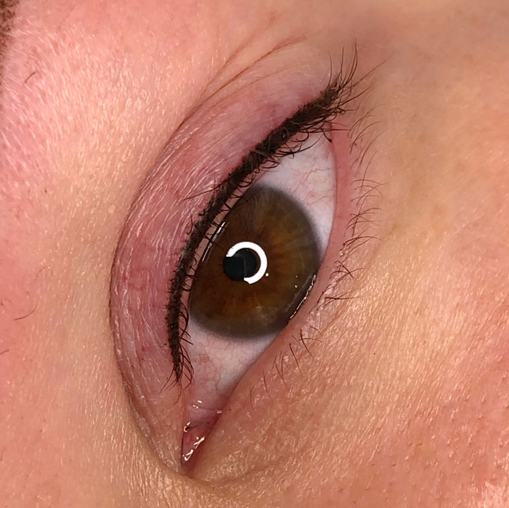 Межресничка