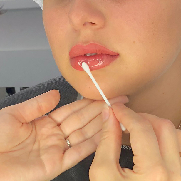 ПМ губ (первичная процедура)