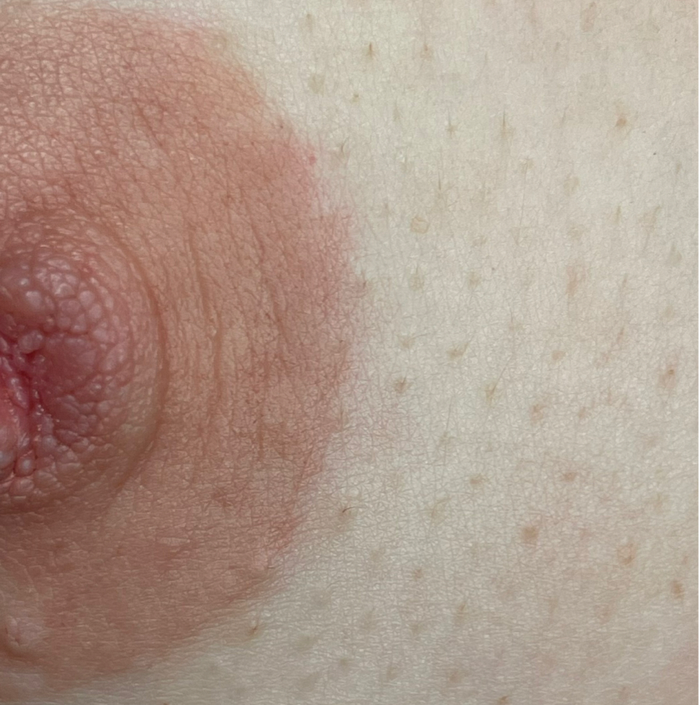 Восстановление ореолов