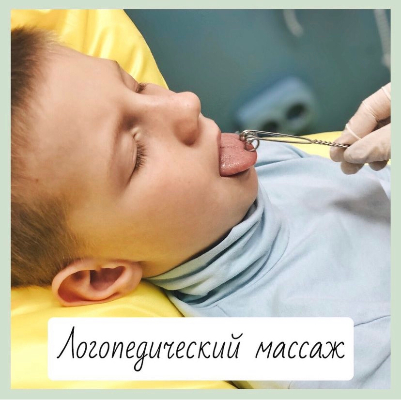 Логопедический массаж