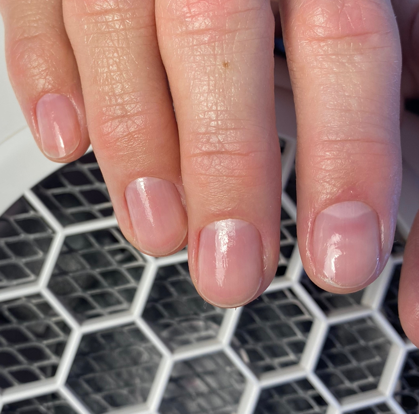 Снятие искусственного покрытия