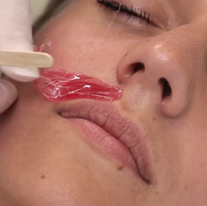 Депиляция усики