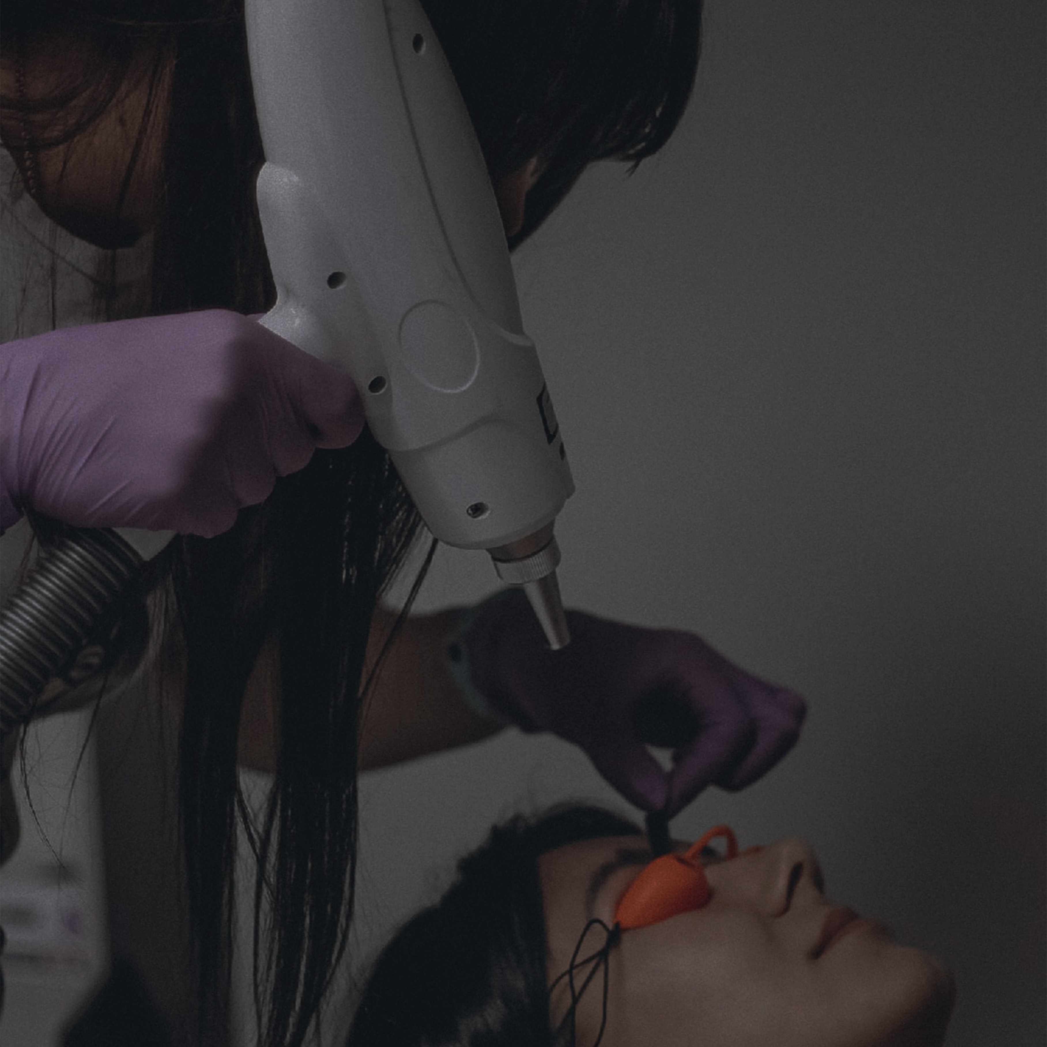 LAZER DAY - каждое воскресенье, удаление тату по акции