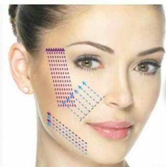 ВЕКИ
Уменьшение мешков под глазами нитями
Эффект ориентировочно 18 мес