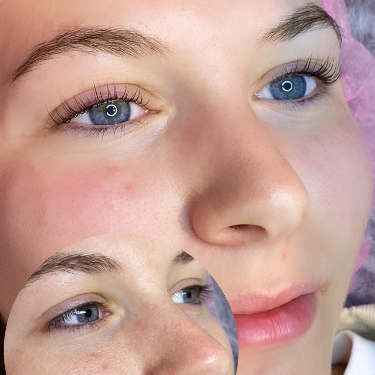 Ламинирование ресниц