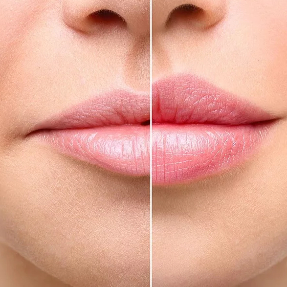 Деликатные губы