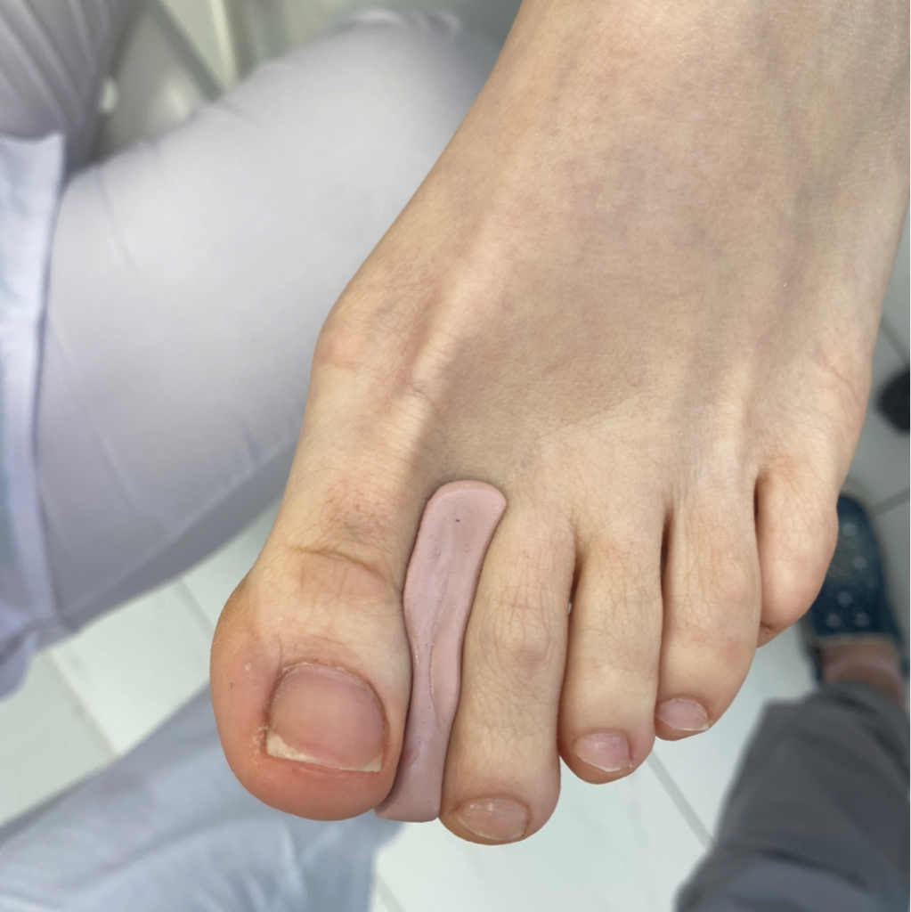 Ортезы и съемный бандаж