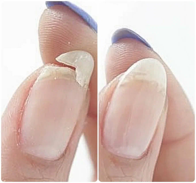 Ремонт 1 ногтя