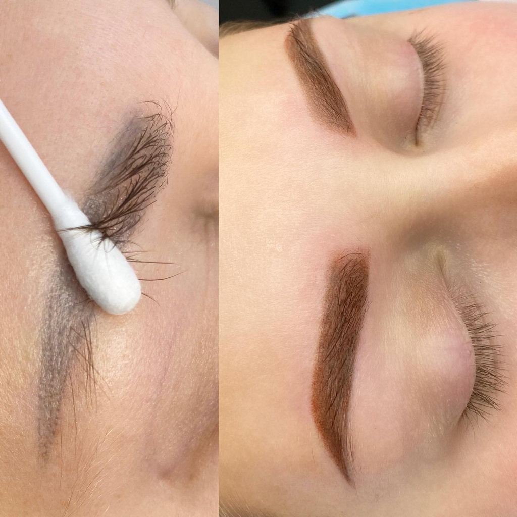 Удаление перманентного макияжа