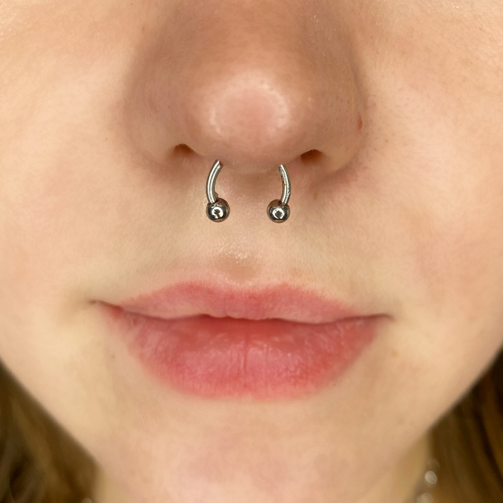 Чистка микродермала