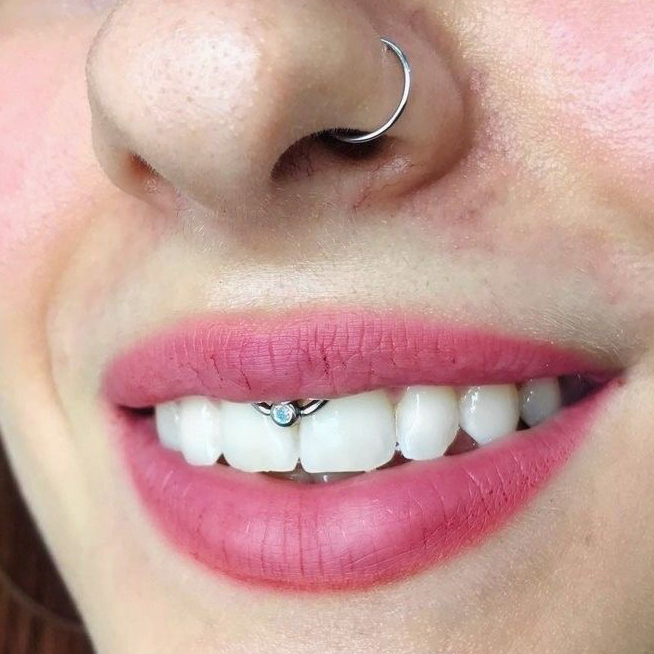 Замена украшения