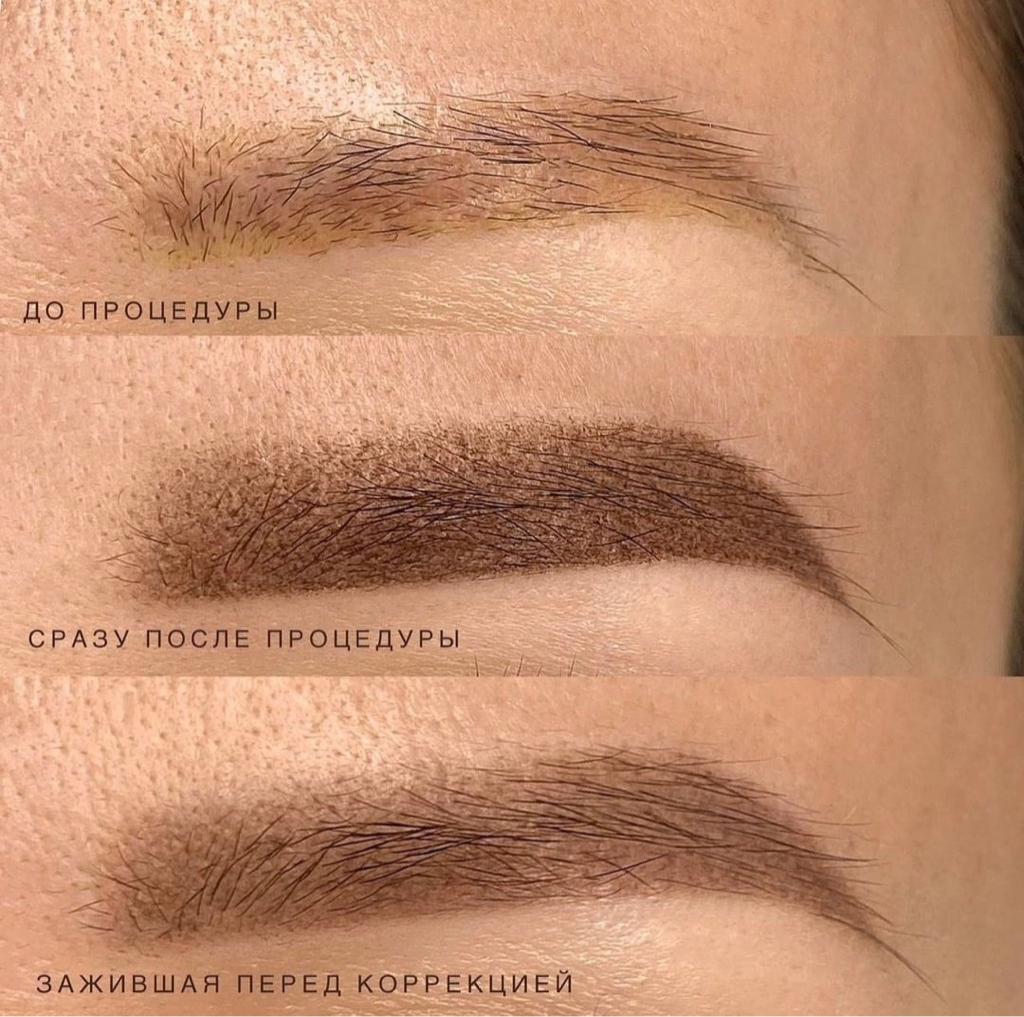 Консультация