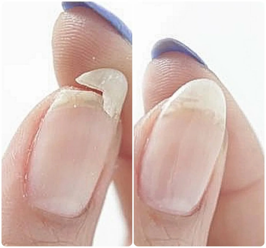 Ремонт ногтя или несколько