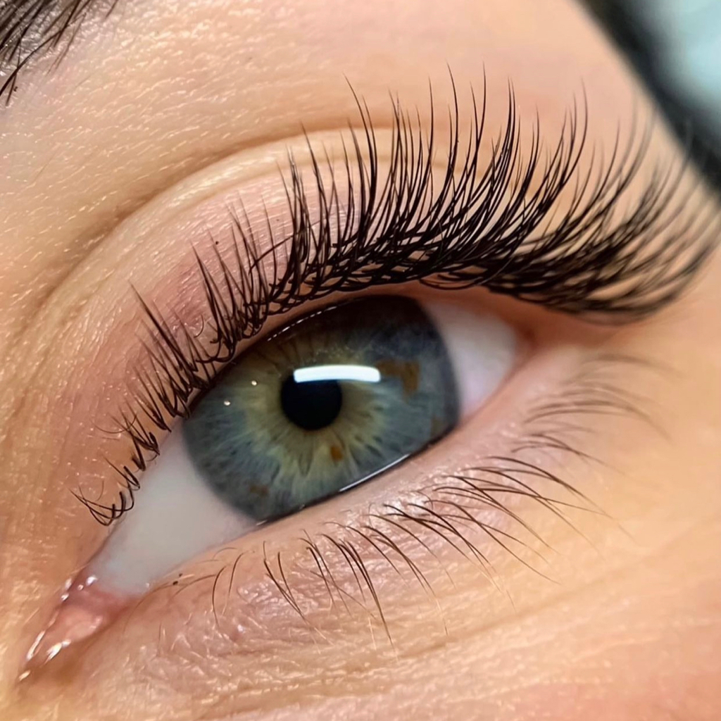 Класичне нарощування