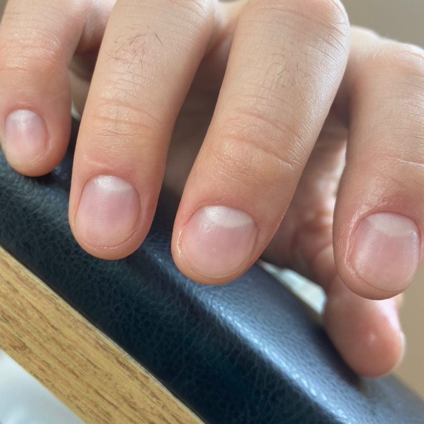 Гигиеническая обработка