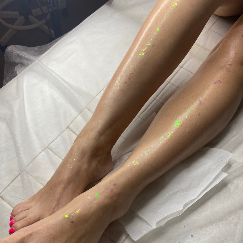 Депиляция голени+колени