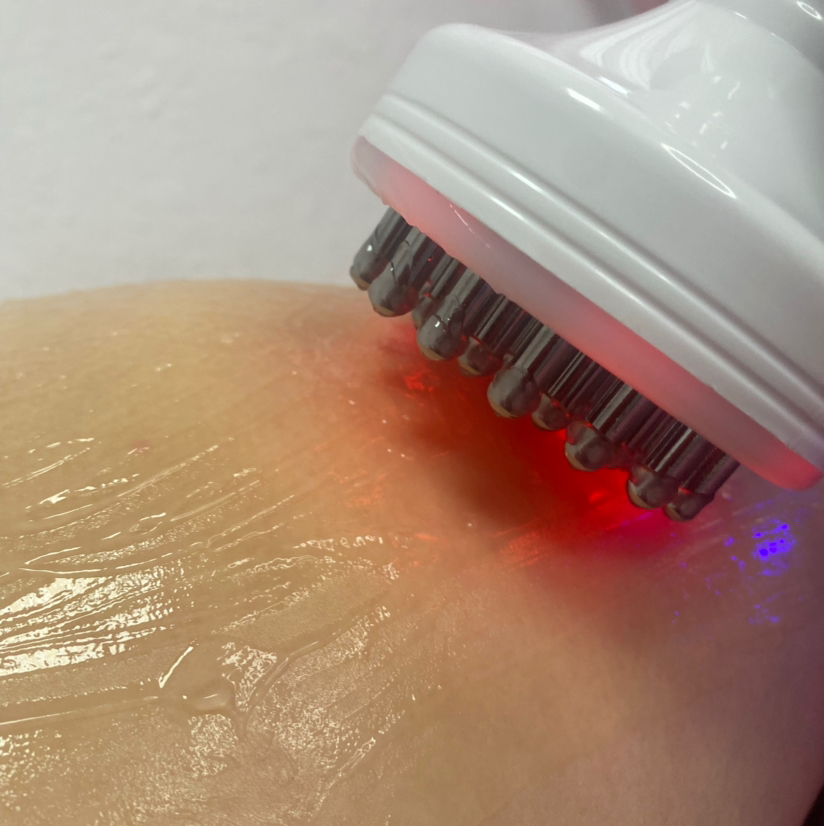 Микротоковая терапия по телу