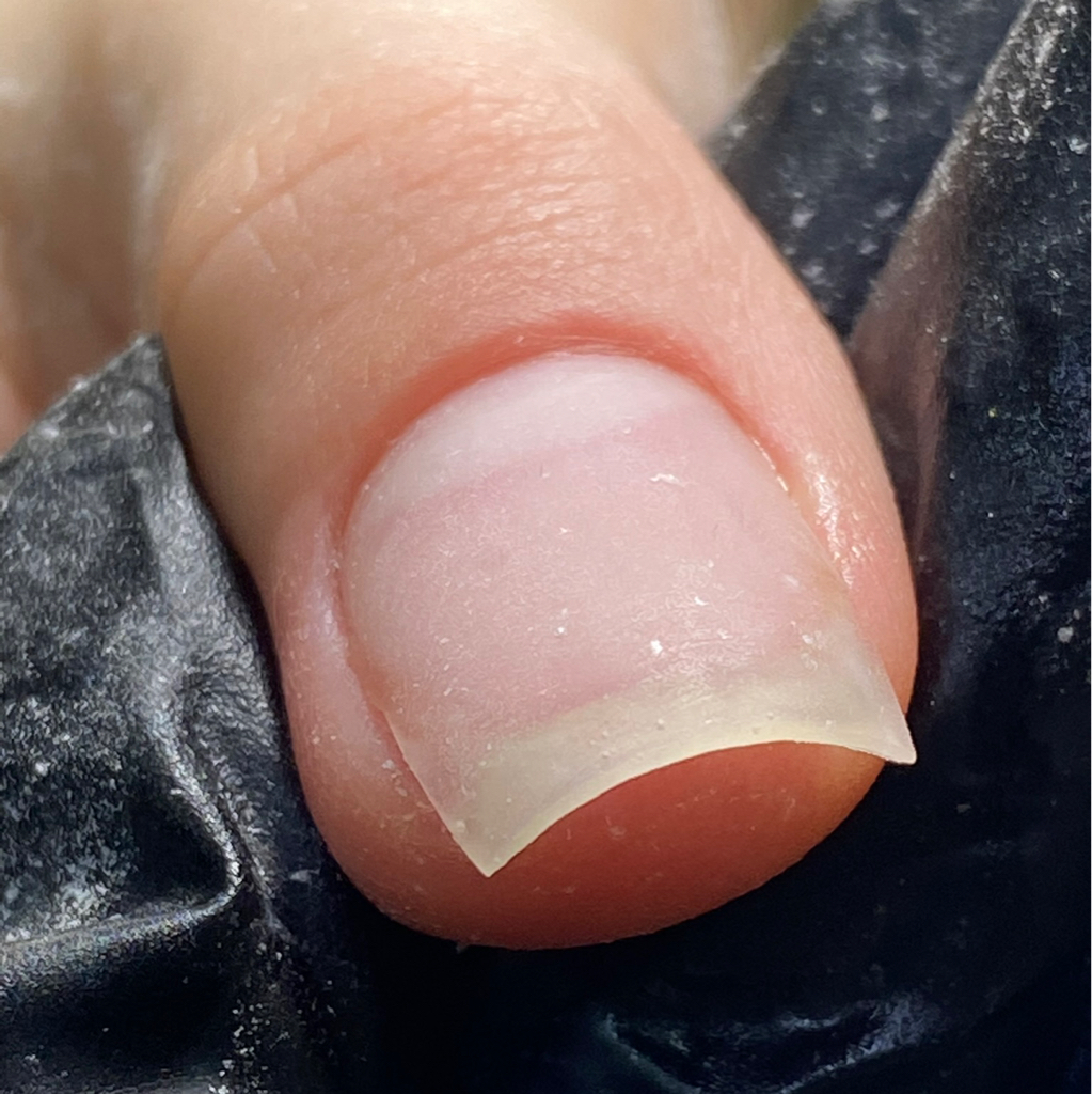 Ремонт ногтя