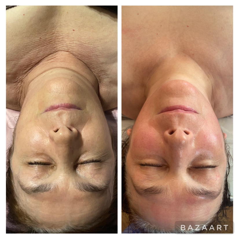 Скульптурно-букальный массаж лица