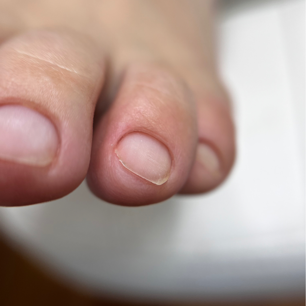 Комбинированный педикюр