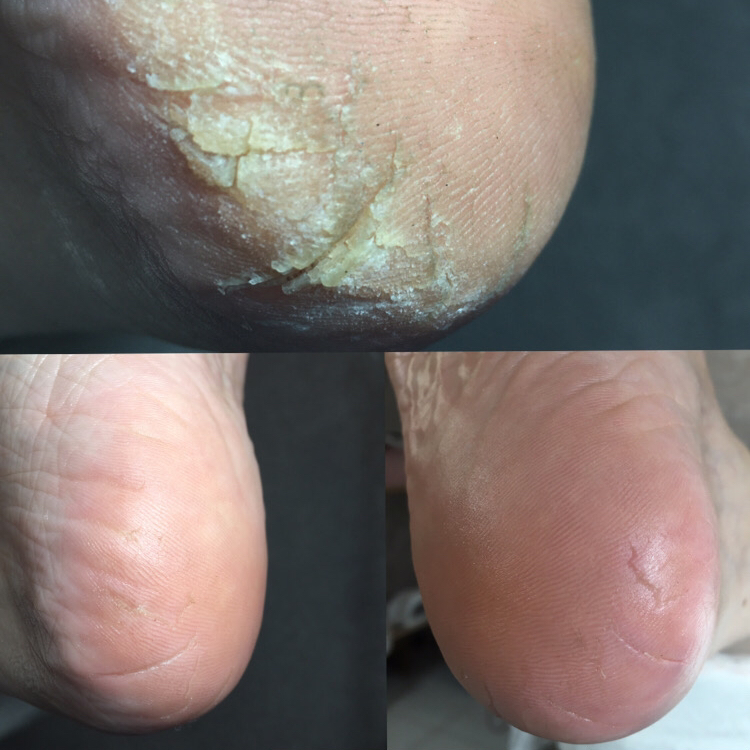 SMART-Педикюр полный+покрытие гельлак