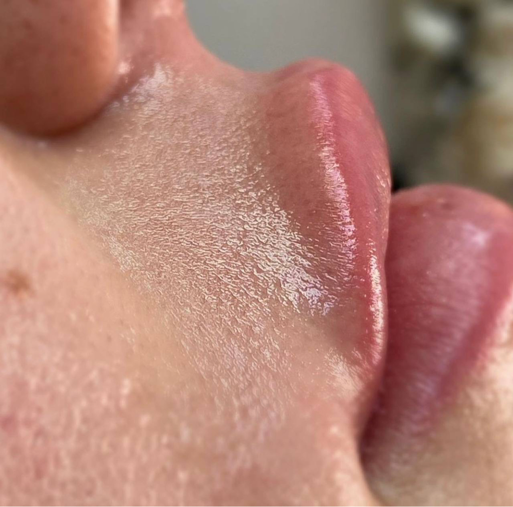 Лицо 1 зона (верхняя губа/подбородок/бакенбарды/лоб/щеки)