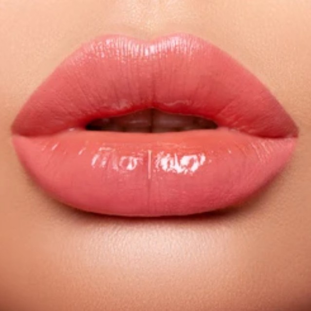 Увеличение (аугиентация) губ