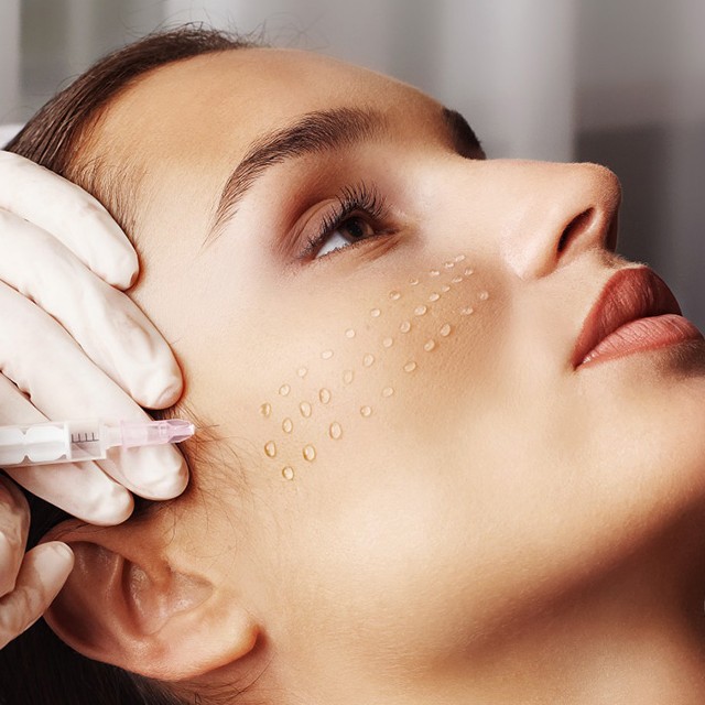 Биовитализация