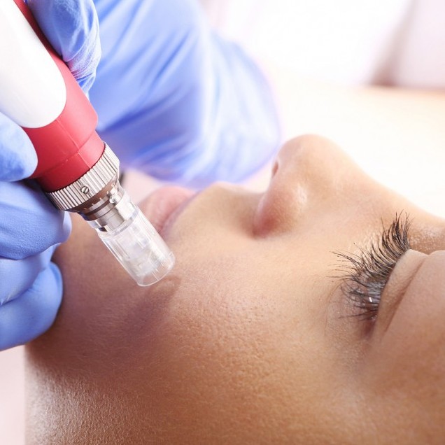 Микронидлинг