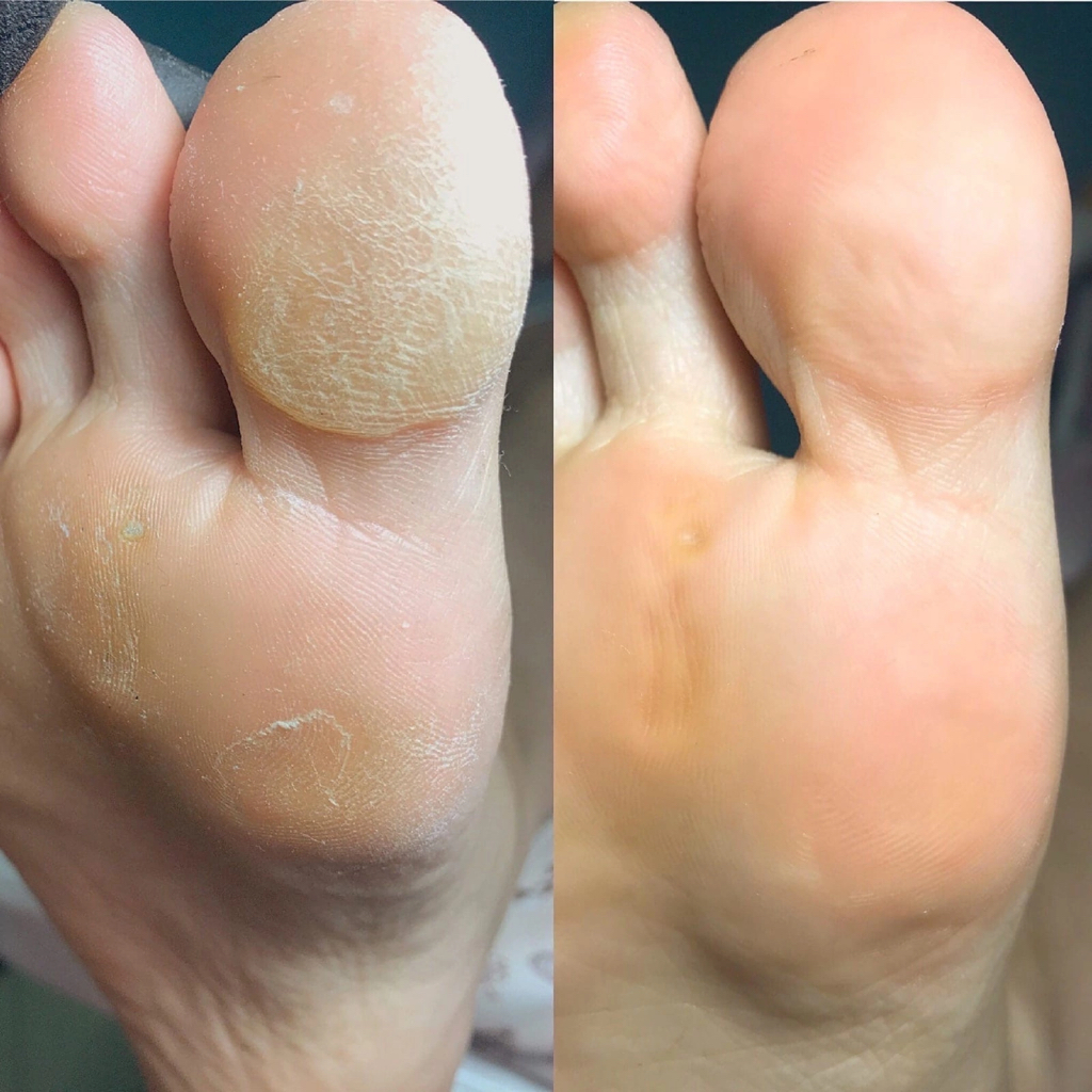 SMART - педикюр без покрытия гель-лак (обработка стоп + пальцев)