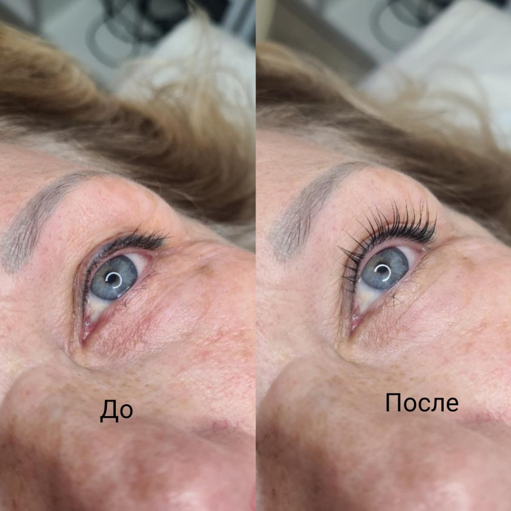 Ботокс ресниц