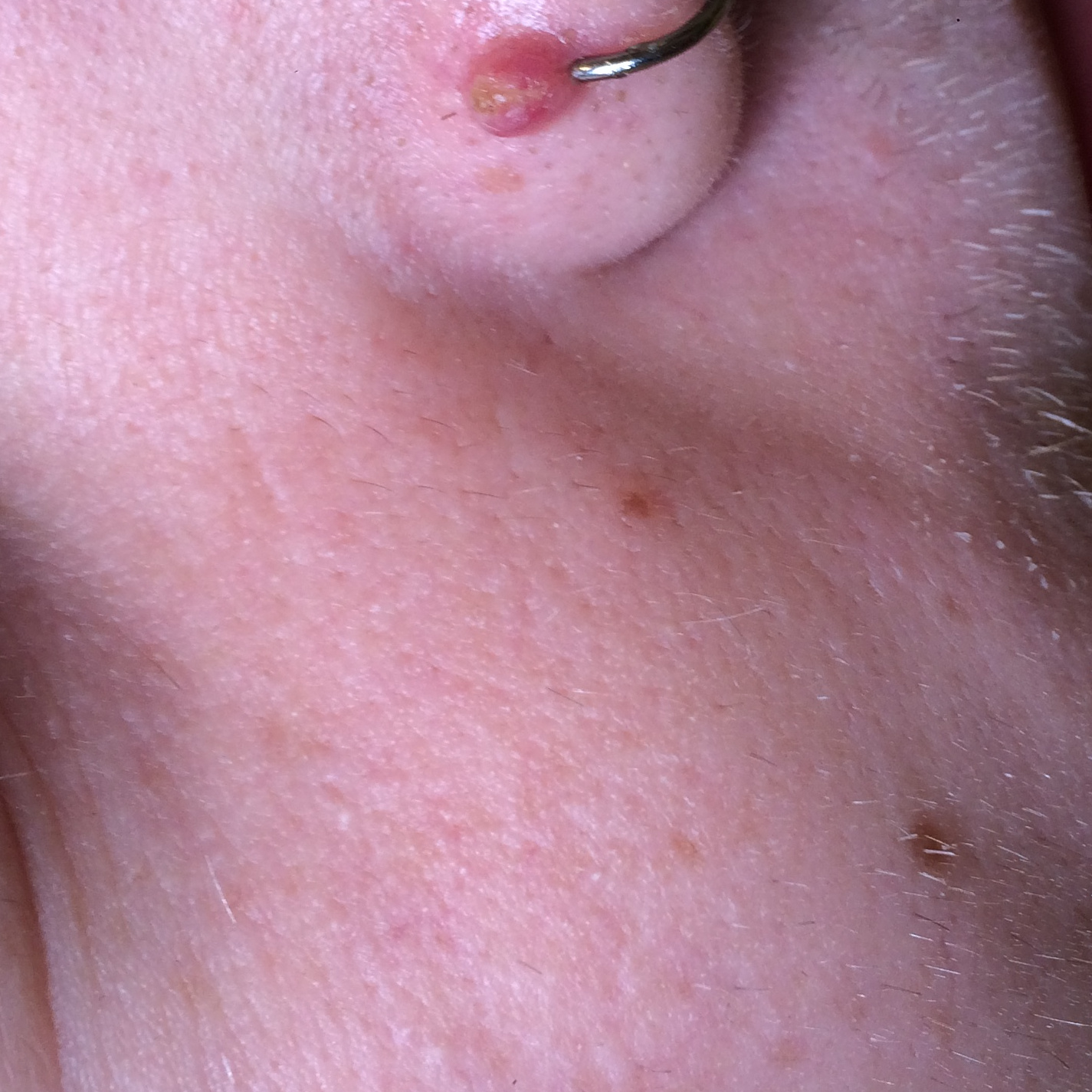 Пи**ц всё опухло