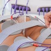 МИОСТИМУЛЯЦИИ ТЕЛА