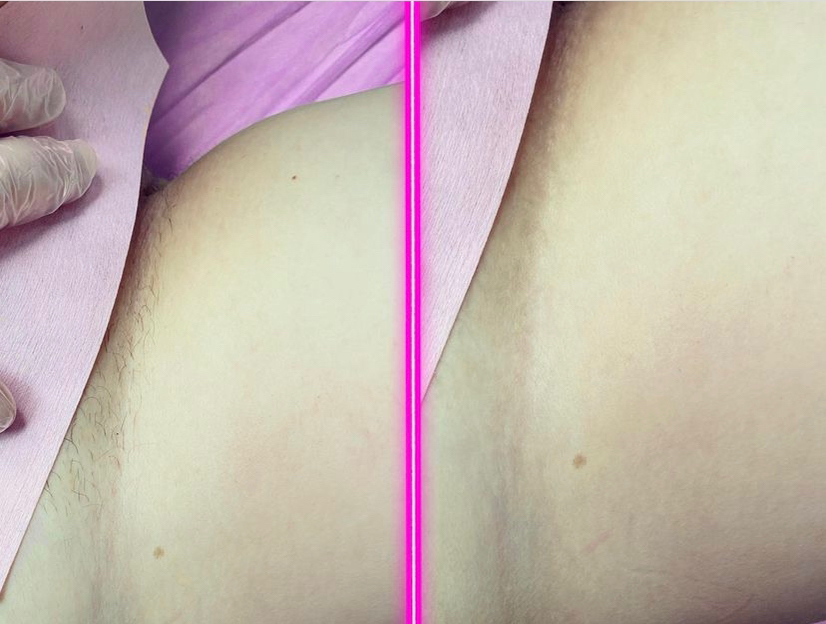 Классическое бикини