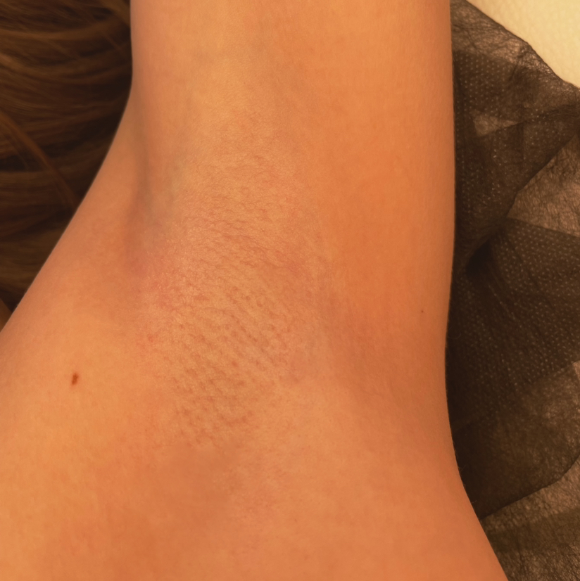 Подмышечные впадины