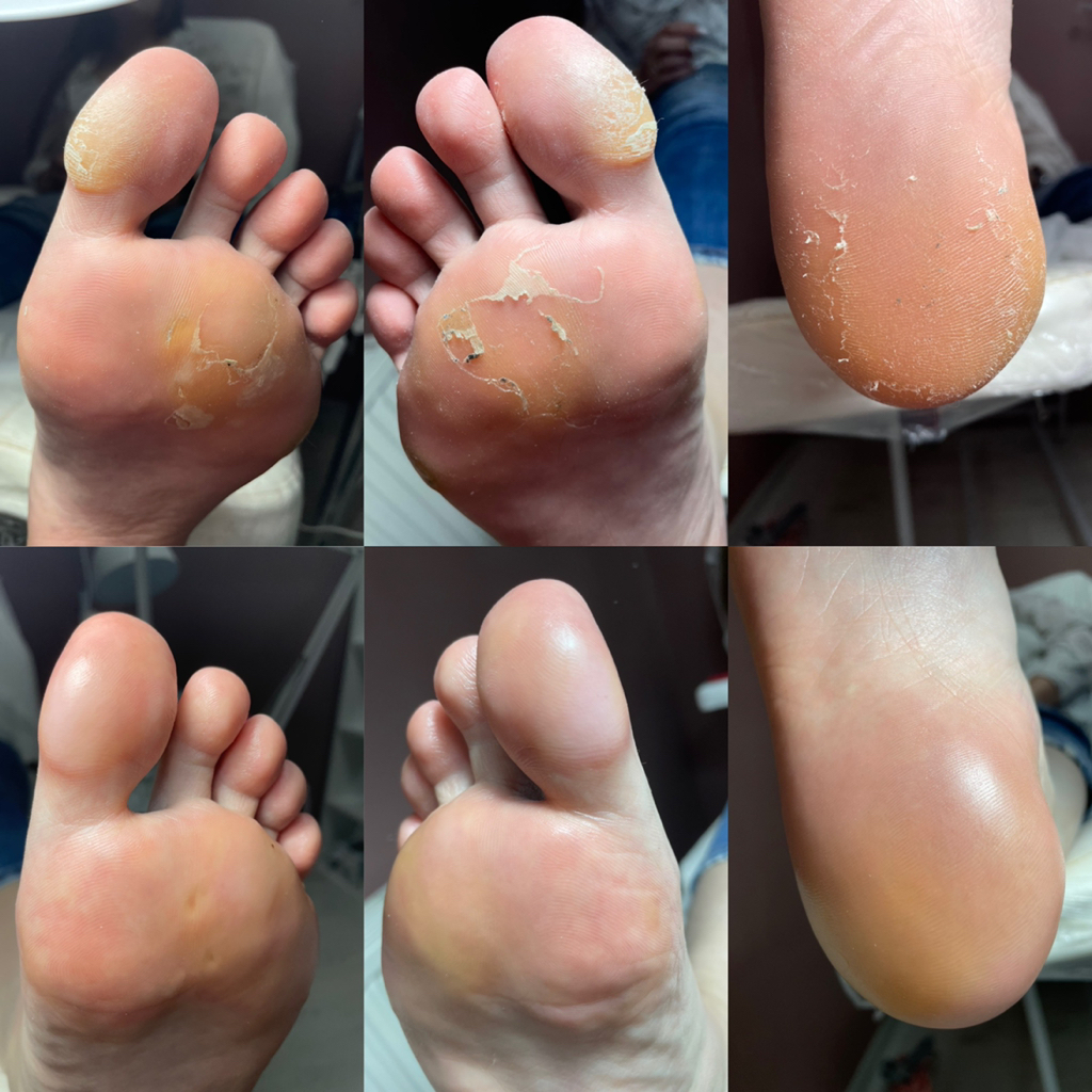 Smart педикюр без покрытия