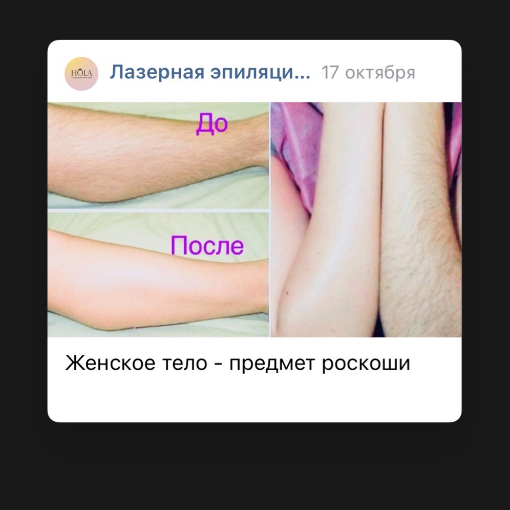 Лазерная эпиляция: руки до локтей