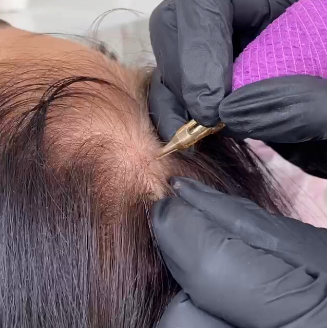 Трихопигментация головы