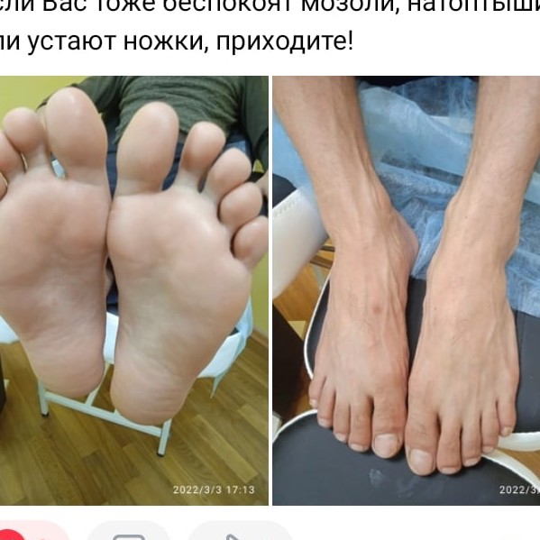 Педикюр Аппаратный