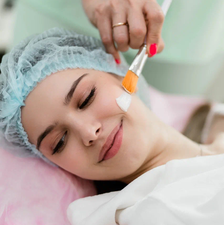 Химический пилинг