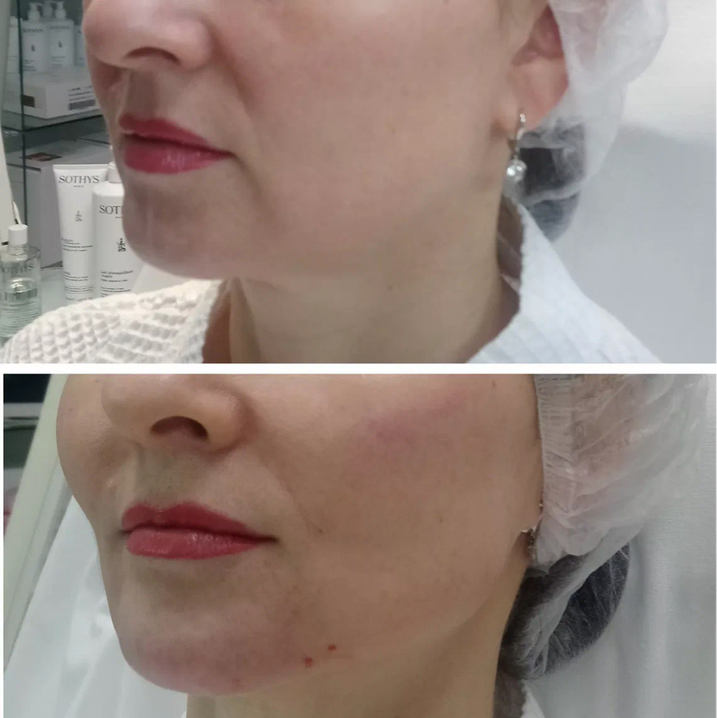 Комплексная коррекция