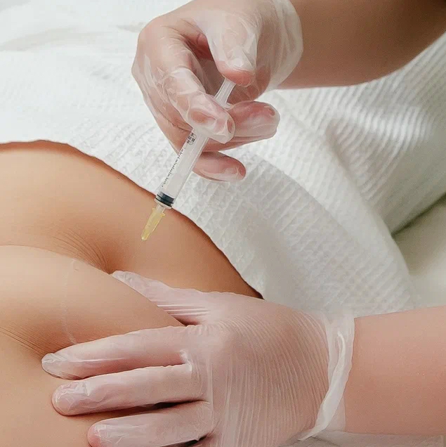 Липолитик по телу