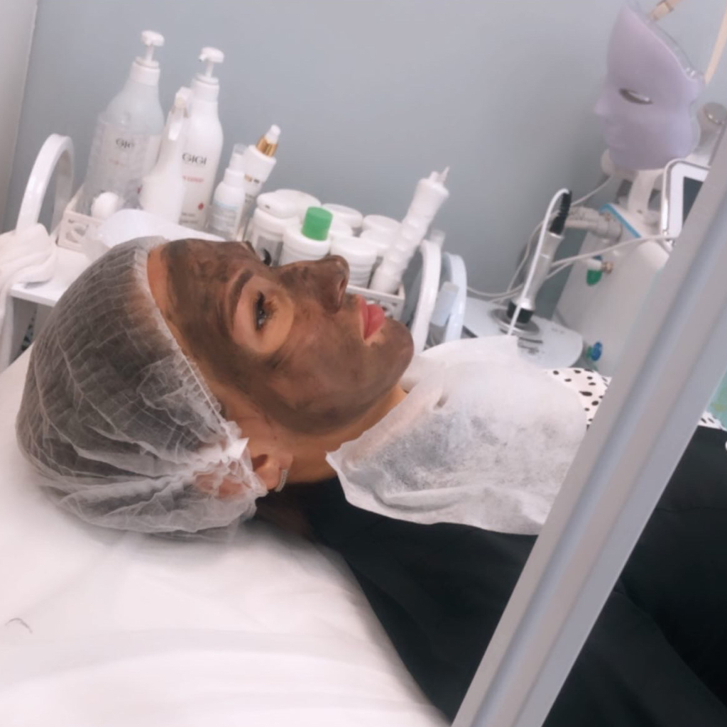 Карбоновый лазерный пилинг