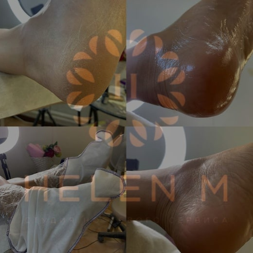 Spa уход для ног