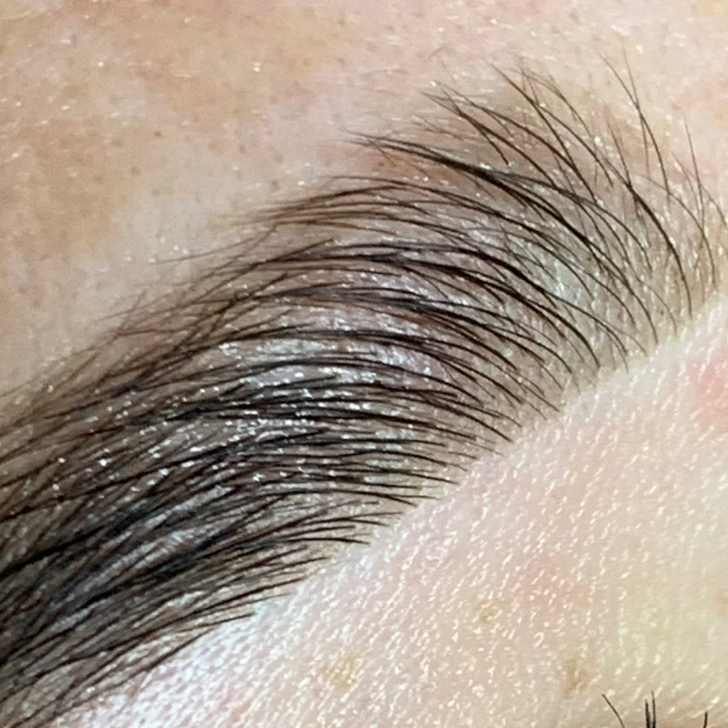 Ботокс для бровей