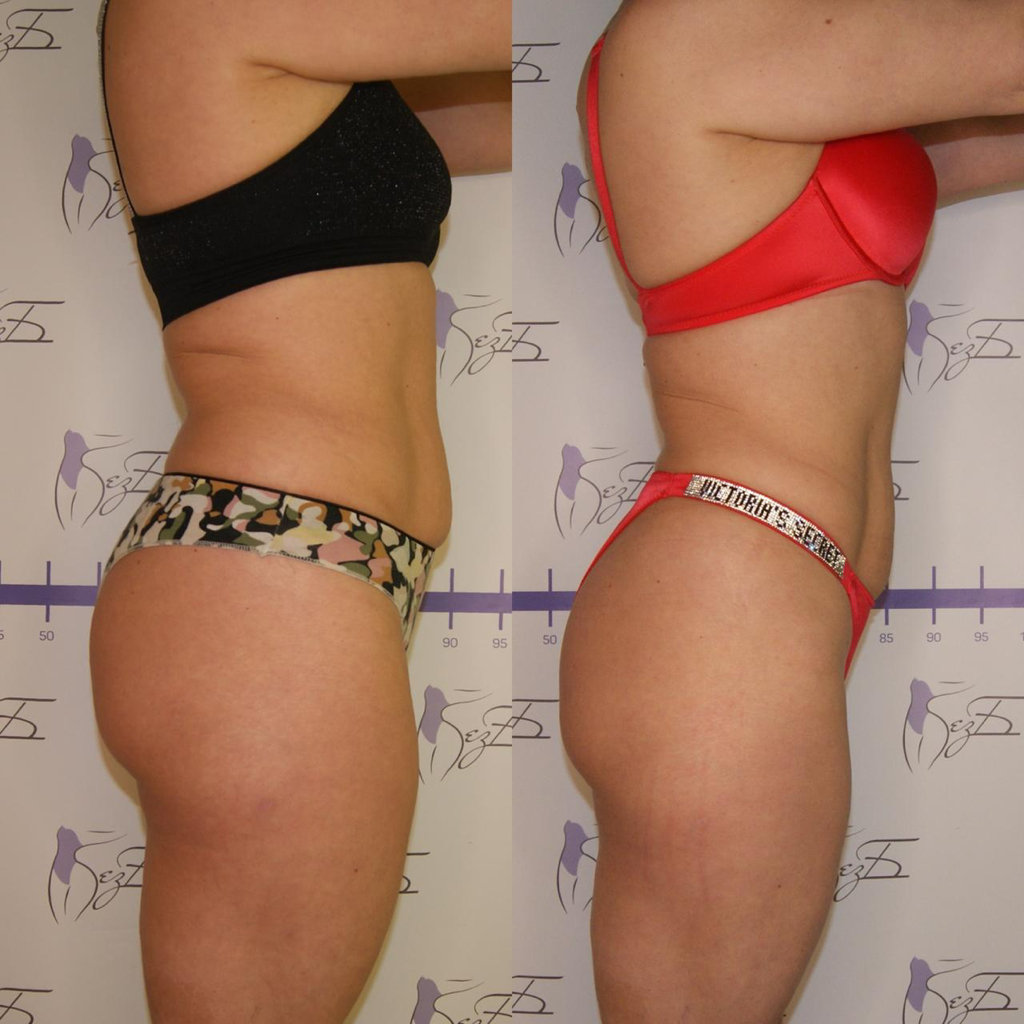 Корректирующий массаж всё тело(без абонемента)