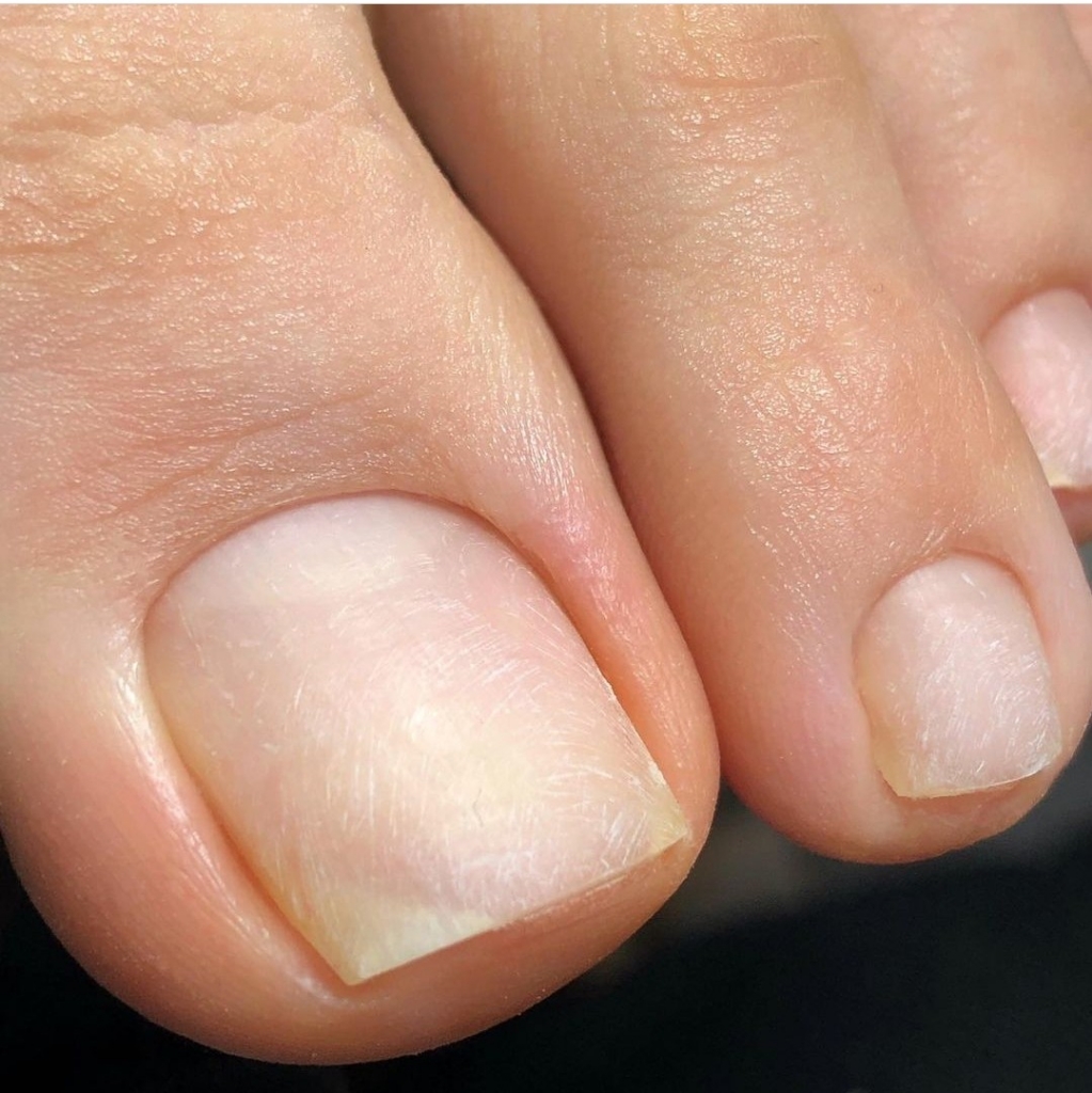 педикюр с полной обработкой стопы и пальчиков без покрытия